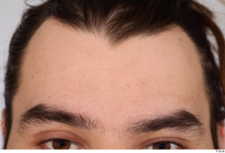 Turgen forehead head 0001.jpg